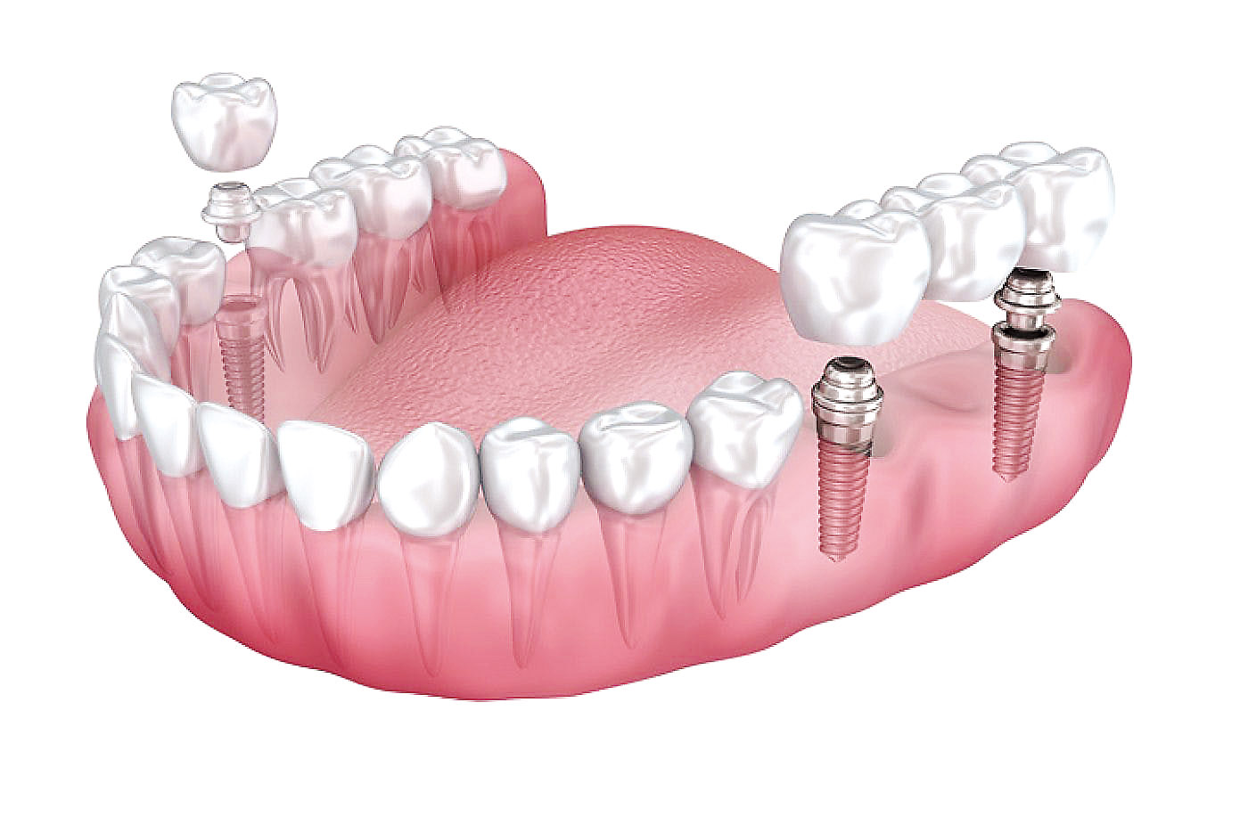 牙齒健康是最自然的方式抵抗COVID 19 沈維信牙醫博士助您重捨牙齒健康 